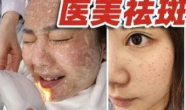 解斑最新爆料,最新爆料背后的惊人真相